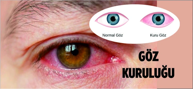 UZUN SÜRE EKRANA BAKMAK GÖZ KURULUĞU SEBEBİ