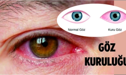 UZUN SÜRE EKRANA BAKMAK GÖZ KURULUĞU SEBEBİ