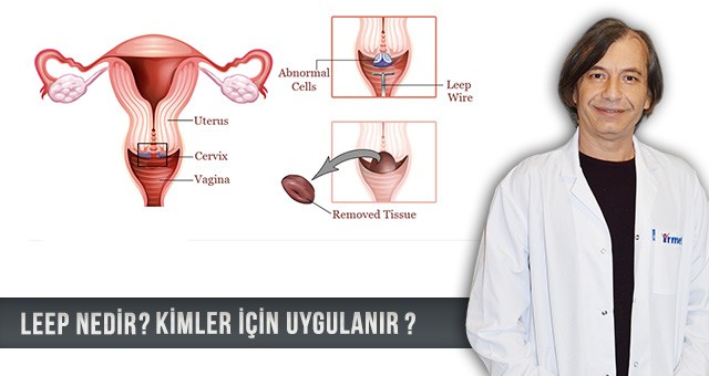 İRMET’TE KANSER ÖNCÜSÜ LEZYONLARINA UYGULANAN EN MODERN İŞLEM: LEEP KONİZASYON İŞLEMİ